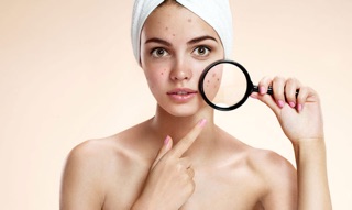SERUM MỤN DEW & DEW
