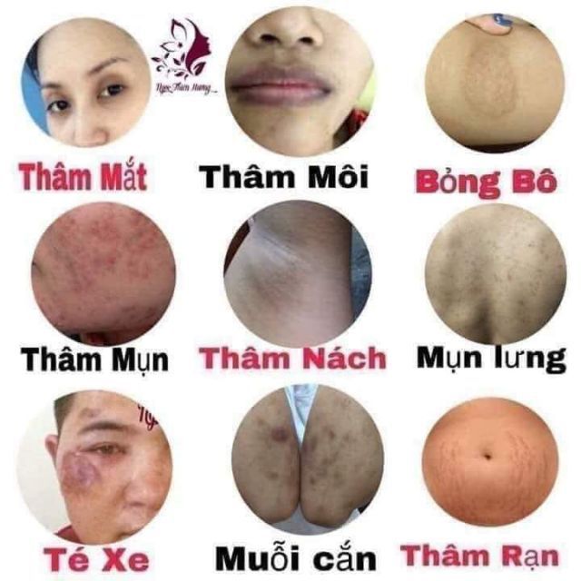 Ol Cell hút thâm nách, thâm môi,thâm body