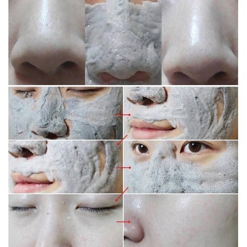 Mặt Nạ Thải Độc, Khử Chì Bì Heo Hàn Quốc Carbonated Bubble Clay Mask