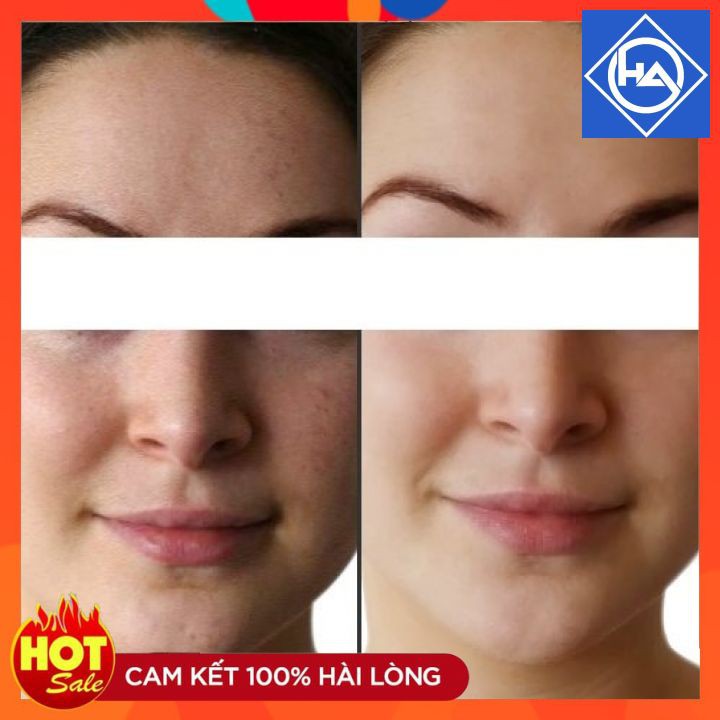 1 lọ Vi tảo sinh học Ronas Resting Peel