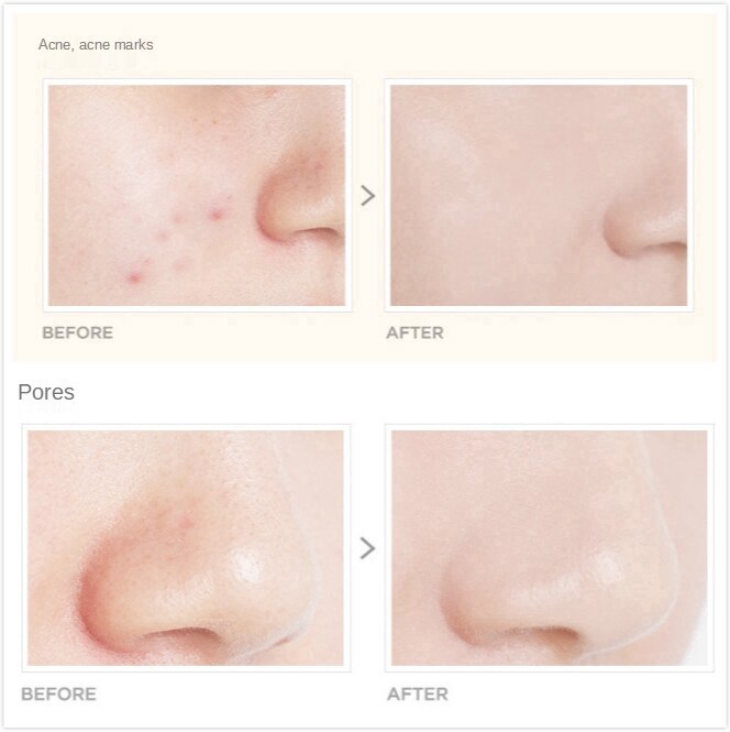 (Hàng Mới Về) Kem Nền Che Khuyết Điểm Lâu Trôi Chống Thấm Nước Giúp Làm Mờ Sẹo Mụn Và Quầng Thâm | BigBuy360 - bigbuy360.vn