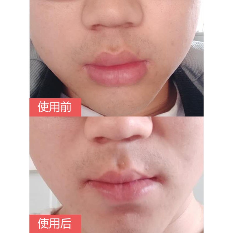 Tinh Dầu Dưỡng Ẩm Làm Mỏng Môi 2 Trong 1