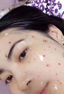 Mặt nạ COLLAGEN