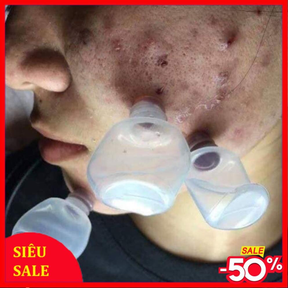 Ống Hút Máu Bầm Combo 100 Ống