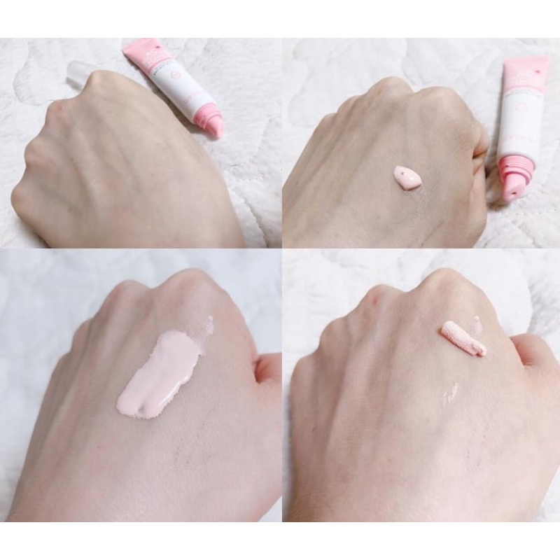 Kem Dưỡng Giảm Mụn Viêm, Mụn Sưng Mủ, Mờ Thâm, Mờ Sẹo, Giảm Mụn Ẩn G9Skin Calamine Gel Spot Patch LOVESKINCARE VN