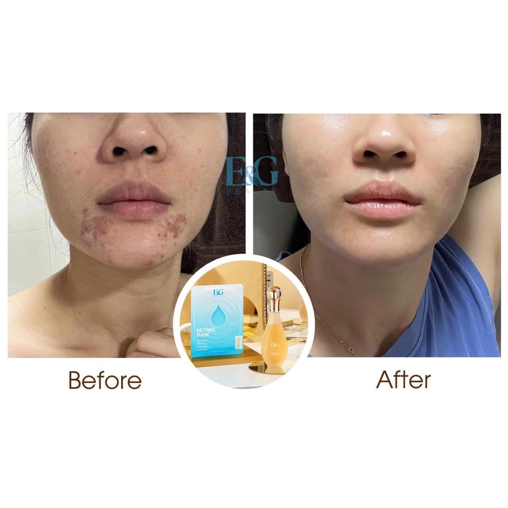 Nước thần Revitalizing E&G Beauty Hàn Quốc phục hồi, tái tạo, hồi sinh làn da 100ml