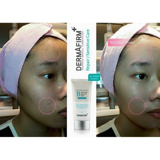 Kem nền Dermafirm Intensive Blemish Balm