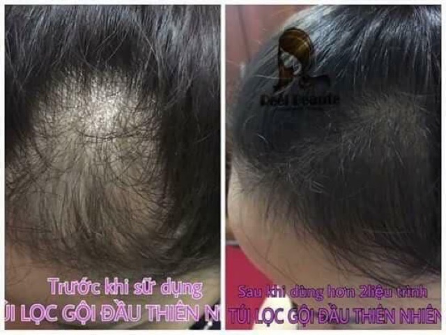 Túi Lọc Gội Đầu Reel Beaute