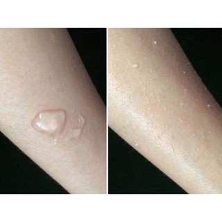GEL TẨY TẾ BÀO CHẾT BOTANICAL