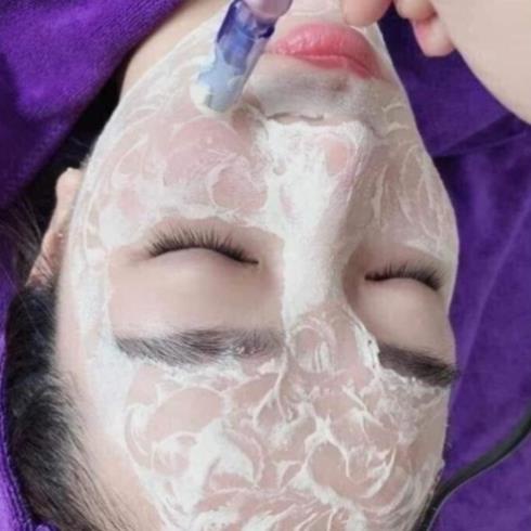 Phấn Mesowhite, Cấy Phấn Mesowhite Cao Cấp