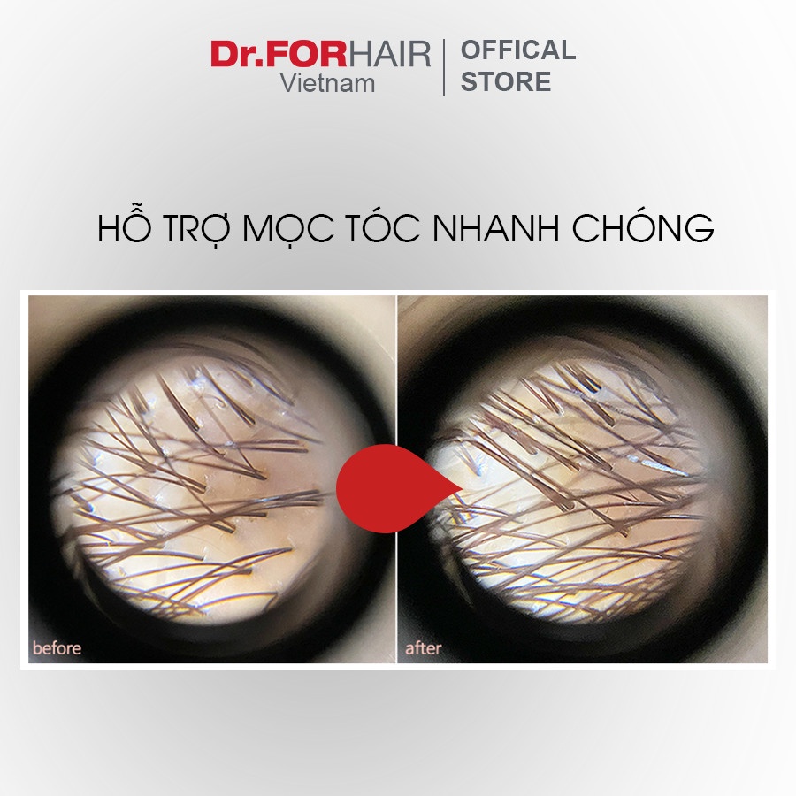 Bộ gội xả dưỡng Mini giúp GIẢM RỤNG TÓC, chăm sóc tóc chắc khỏe từ bên trong của Dr.FORHAIR Folligen Plus x Scalp Pack