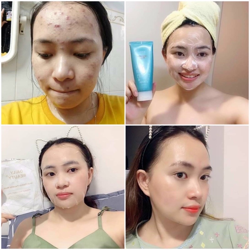 Mặt Nạ Nhau Thai cừu Hàn Quốc