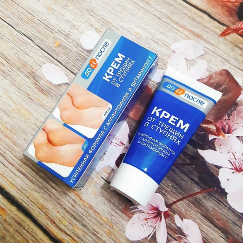 Kem Nứt Gót Chân ❤️𝑭𝒓𝒆𝒆𝒔𝒉𝒊𝒑❤️ Kem Ngăn Ngừa Và Hồi Phục Nứt Nẻ Gót Chân Kpem Nga 50ml