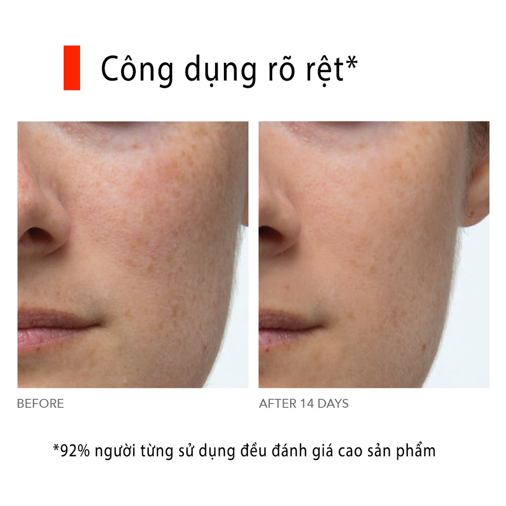 [10 và 20 set] Thay da sinh học cường độ mạnh Dr Dennis Gross Skincare Alpha Beta Extra Strength Daily Peel