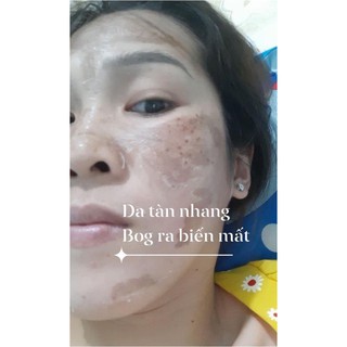 MỸ PHẨM PEEL TCA CHẤM NÁM, RO, TÀN NHANG, ĐỒI MOI..