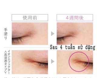 Máy chăm sóc da mặt EH-ST98