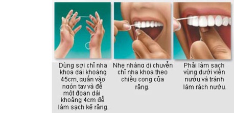 1 cuộn chỉ nha khoa ( 50m)