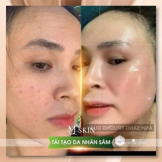 SERUM THAY DA NHÂN SÂM