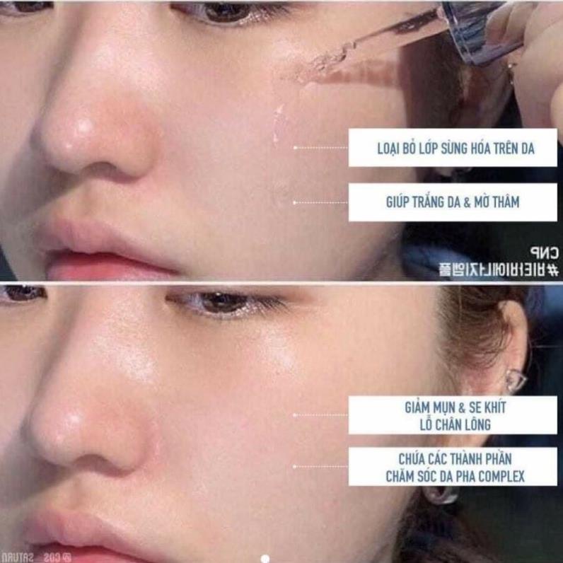 1 vỉ tinh chất tái tạo da Peel CNP RX 2ml