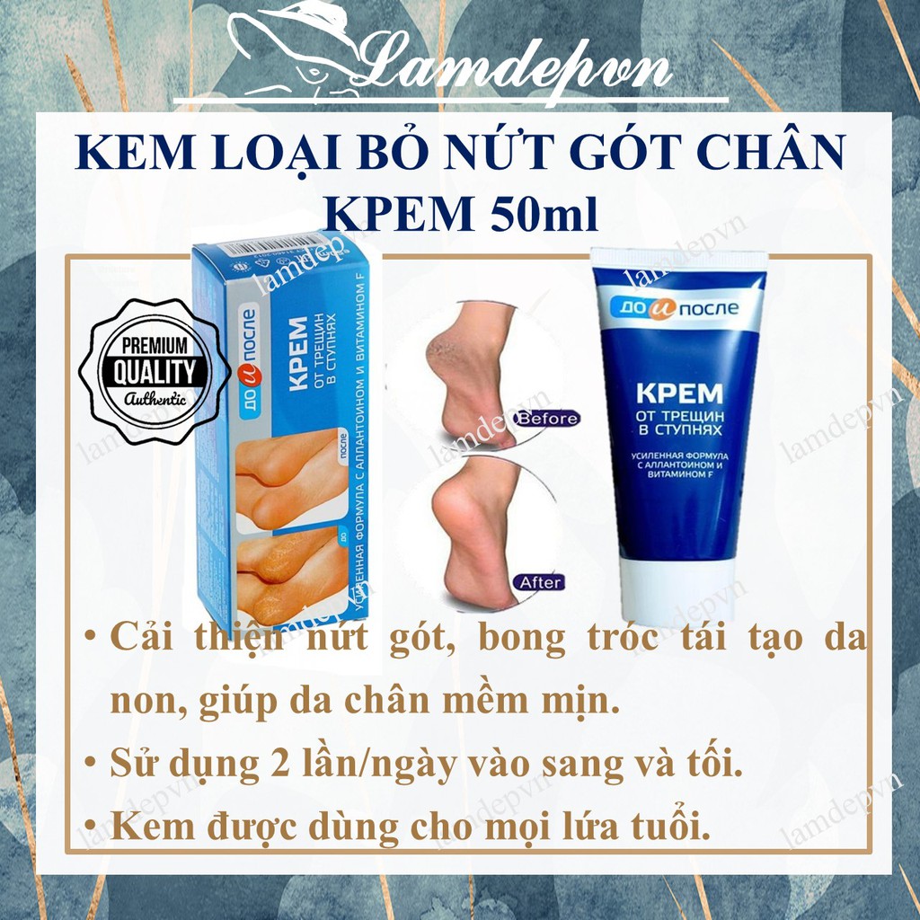 Kem Loại Bỏ Nứt Gót Chân Nga Foot Cream Kpem (Cho Mọi Lứa Tuổi)