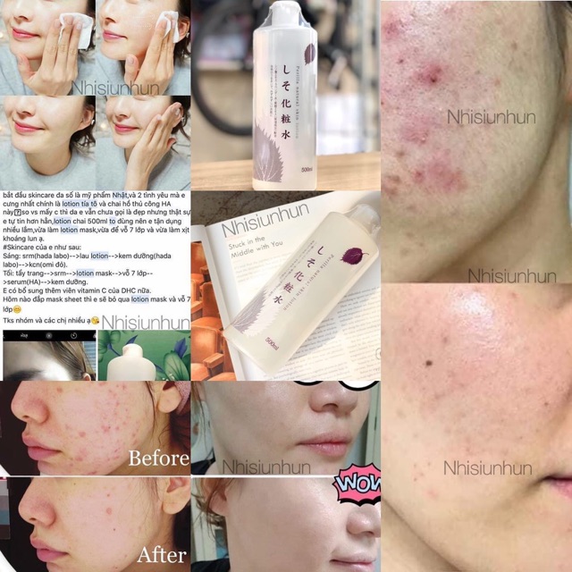 Nước hoa hồng chiết xuất lá tía tô Dokudami Perilla Skin Lotion - Nhật Bản