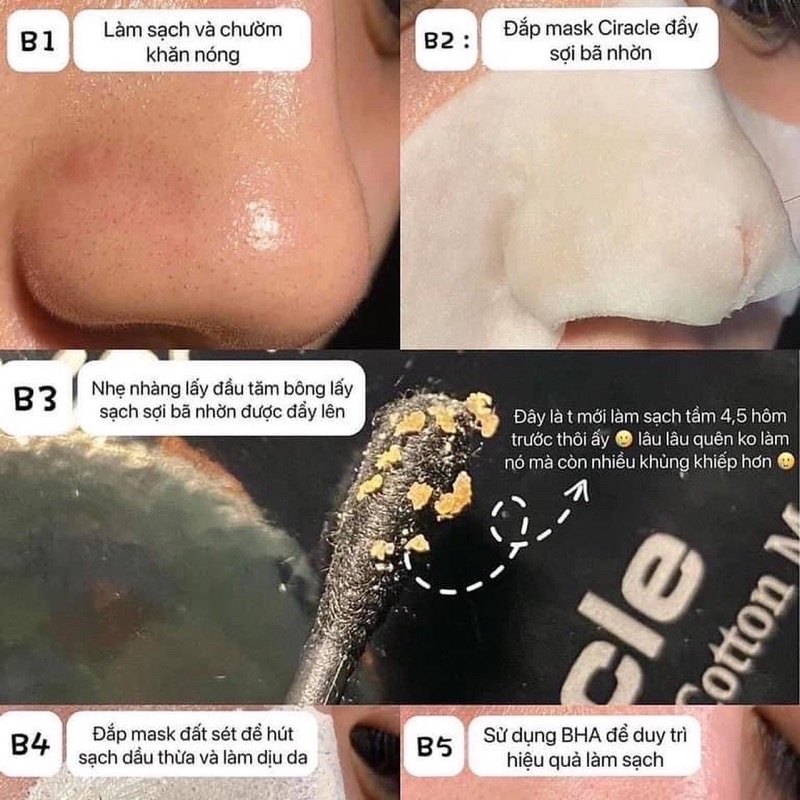 [FREE SHIP] Mặt Nạ Đẩy Mụn Good Bye Của Cỉacle