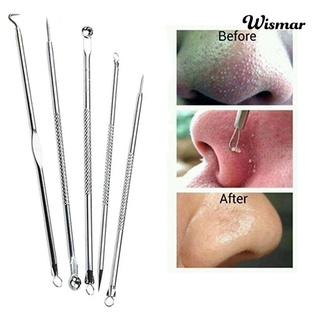 [Hàng mới về] Set 5 Dụng Cụ Nặn Mụn Đầu Đen Chuyên Nghiệp Cho Nữ