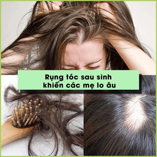 Dầu Gội Thảo Dược Comeon Hết Gàu - Giảm Rụng Tóc - Kích Thích Mọc Tóc - Chuẩn 100% | BigBuy360 - bigbuy360.vn