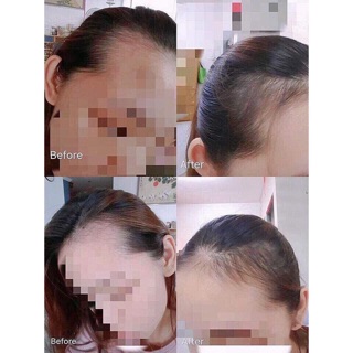 Tinh chất mọc tóc Sato Nhật Bản