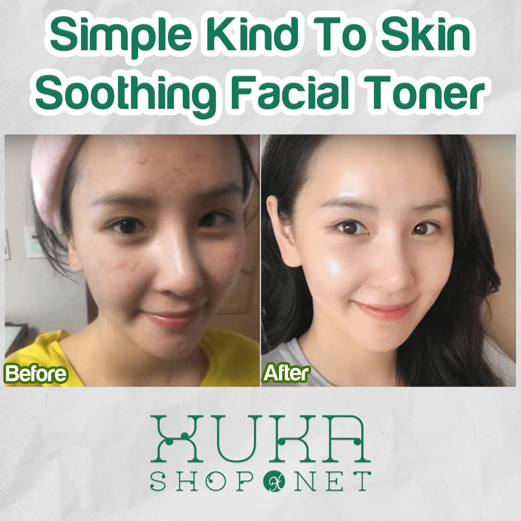 Nước hoa hồng Simple Toner cân bằng dịu nhẹ Simple Soothing Facial Toner cân bằng ẩm cho da nhạy cảm 200ml