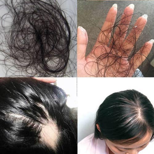 Dầu xả chống rụng tóc và  mọc tóc Hasuo Scalp Pack 230ml