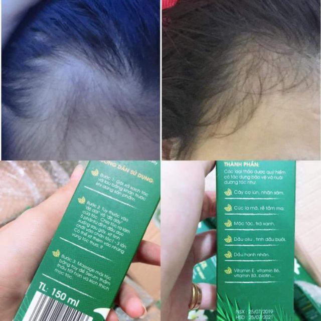 " KÈM QUÀ TẶNG  💌"Hair Care Tonic LA Girl - Serum dưỡng tóc dài 3-5cm/tháng