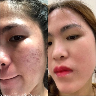 TINH CHẤT HỒNG SÂM TÁI TẠO