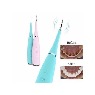 Máy Lấy Cao Răng Cầm Tay Mini Dental FlutterSử Dụng Sạc 3 Chế Độ Rung Loại Sạch Mảng Bám, Cao Răng,Vết Ố Cứng Đầu Nhất