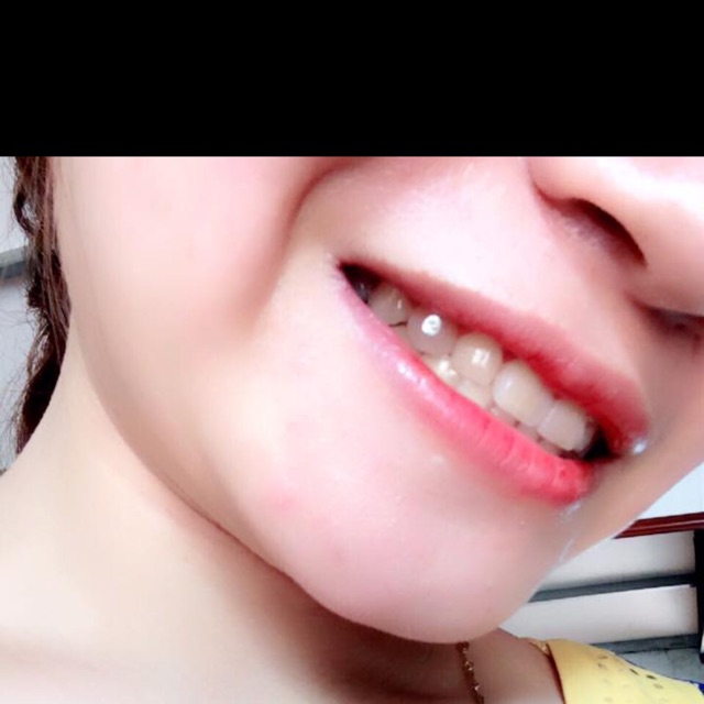 Combo 5v đá đính rĂng