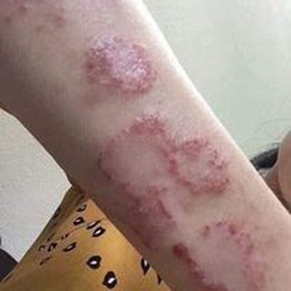 Kem boi da 999 nội địa