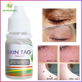 (Hàng Mới Về) Thuốc Mỡ Trị Mụn Cóc Dung Tích 10ml