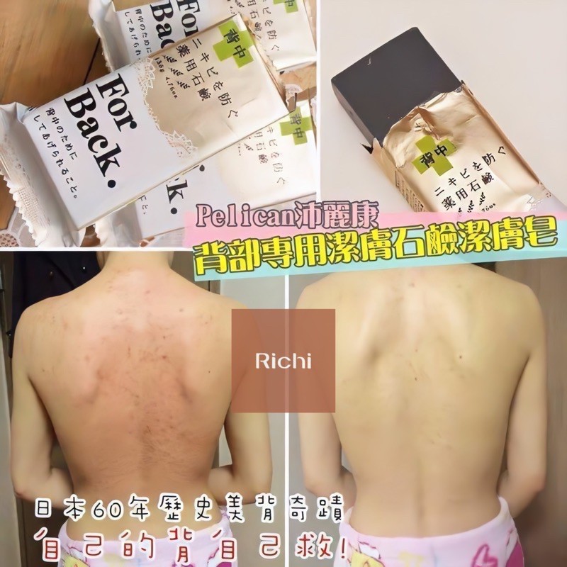 Xà phòng ngừa mụn lưng For back - Xịt For Back