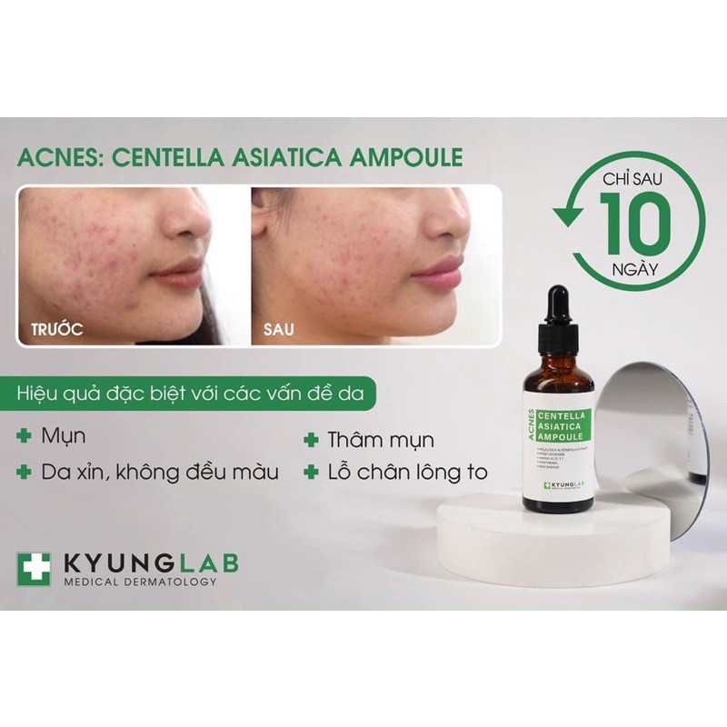 Tinh chất serum giảm mụn, ngừa mụn KYUNG LAB ACNES CENTELLA ASIATICA AMPOULE 50ml