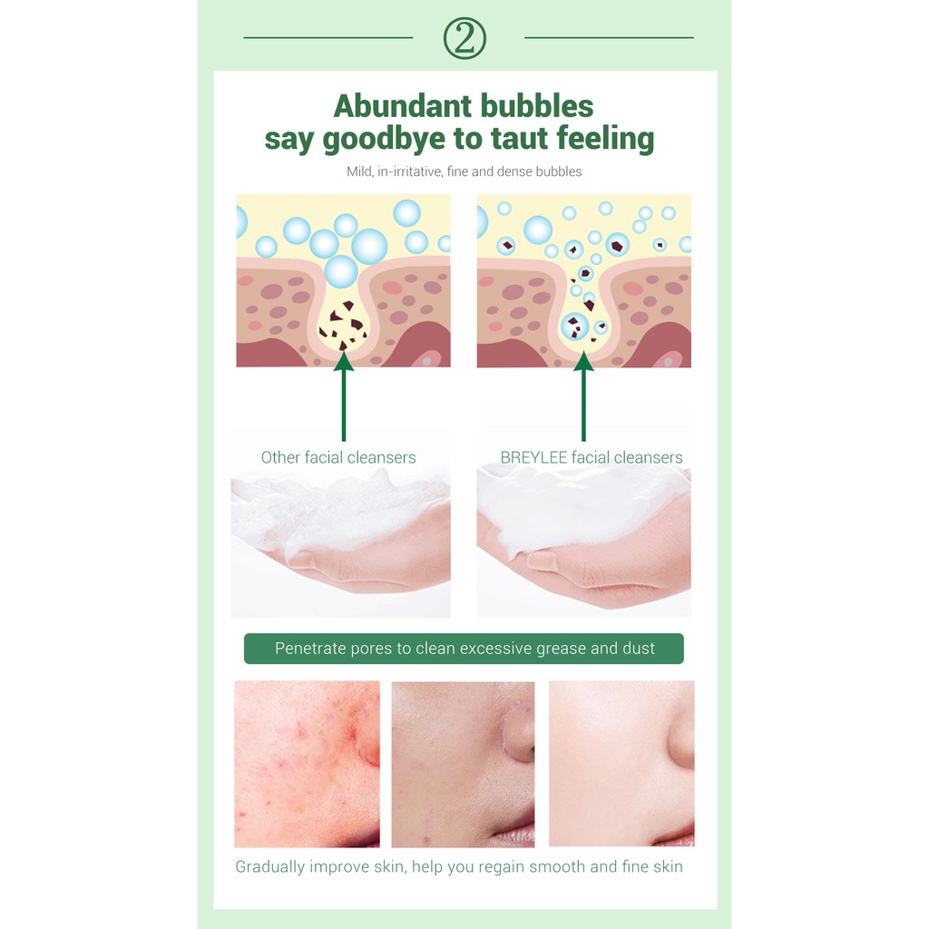 Sữa rửa mặt BREYLEE cải thiện da mụn đầu đen kiềm dầu làm sạch da 100g | BigBuy360 - bigbuy360.vn
