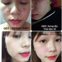 Sắc dược đông y sang sang