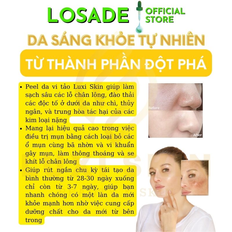 Peel Da Vi Tảo Tái Tạo Da Làm Mờ Vết Thâm Nếp Nhăn, Sẹo Lột Da Để TẩyTế Bào Chết. Thích Hợp Cho Mặt, Nách, Mông Và Lưng