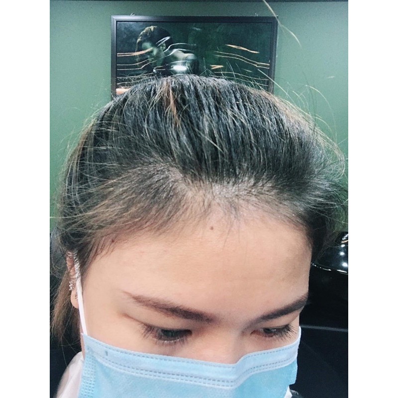 [GIẢM RỤNG 100%] Tinh Dầu Bưởi KÍCH THÍCH MỌC TÓC Vi Jully - Giảm Rụng Tóc - Kích Thích Mọc Tóc - Làm Dài Tóc | BigBuy360 - bigbuy360.vn