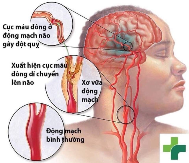 Viên uống bổ não hộp 200 viên của Hàn Quốc