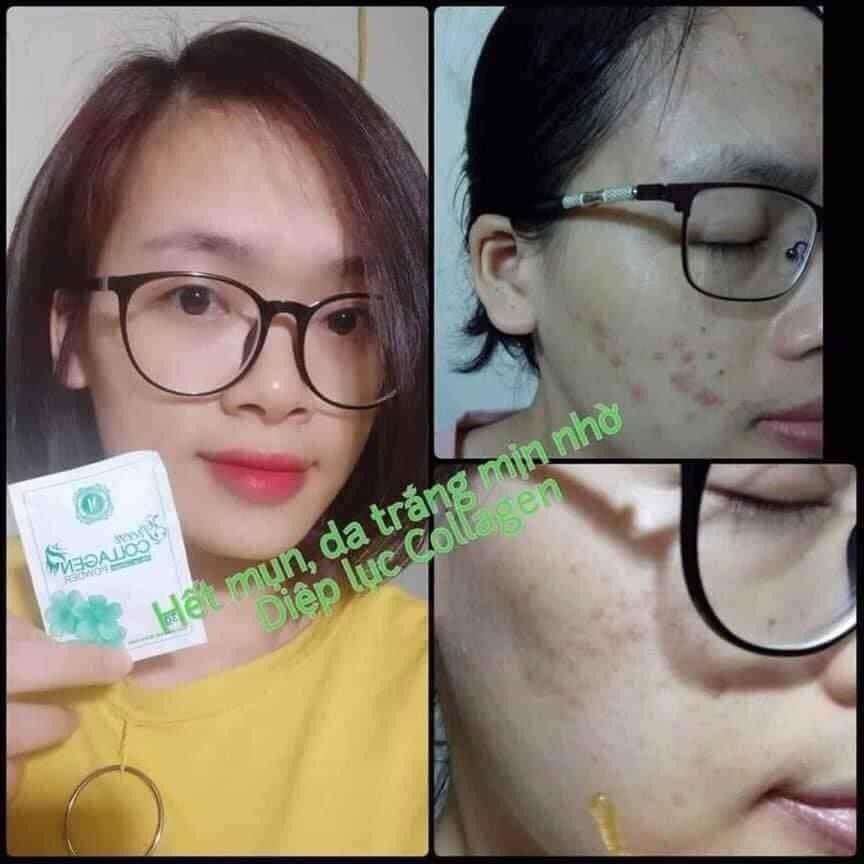 Diệp lục green collagen hỗ trợ làm đẹp da trắng da bổ sung vitamin khoáng chất từ rau xanh giảm táo bón 30gói