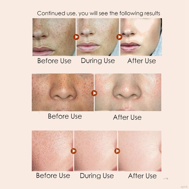 Kem Tinh Chất Retinol Dưỡng Ẩm Làm Trắng Và Săn Chắc Da