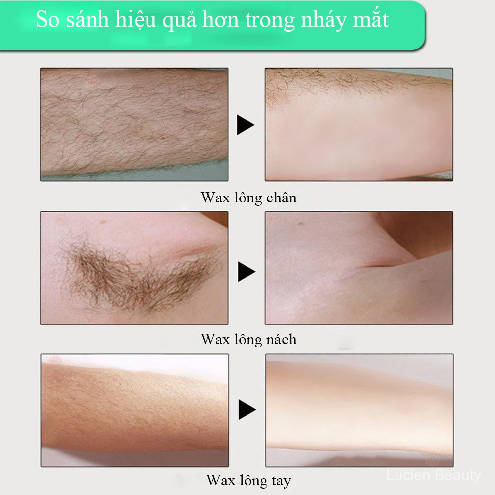 MYQ Kem Tẩy Lông Tái Tạo Da Triệt Lông Wax Lông Hair Removal Cream (Có Che Tên)