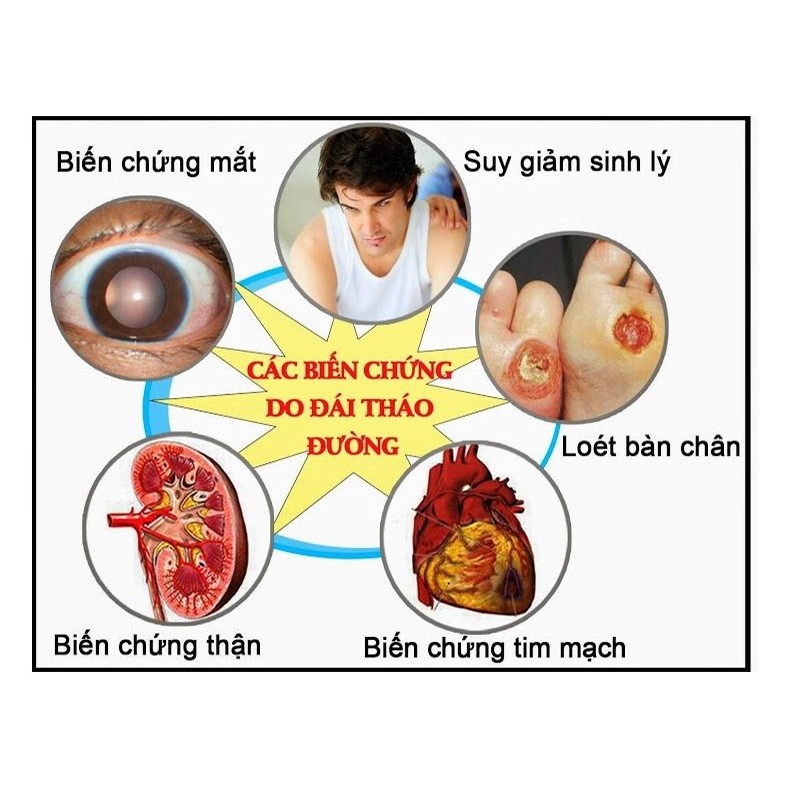 &quot;Cao dây thìa canh LITIC 100g, chống béo phì, giảm mỡ máu, hạ huyết áp, cao dây thìa canh LCDTC100