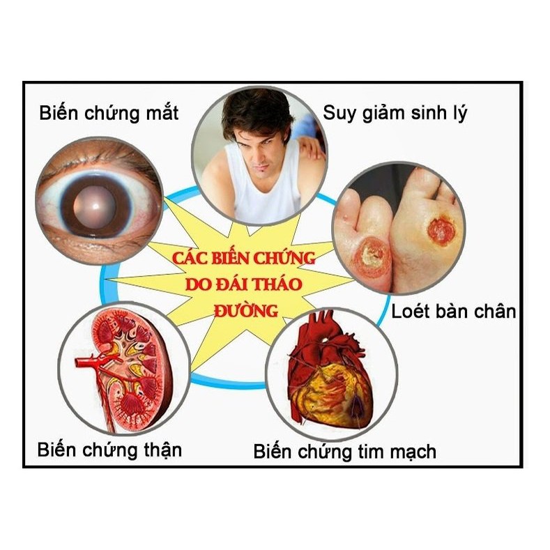 "Cao dây thìa canh LITIC 100g, chống béo phì, giảm mỡ máu, hạ huyết áp, cao dây thìa canh LCDTC100