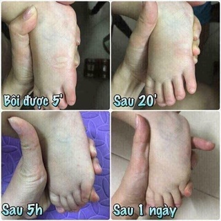 Dầu Sả Thoa Muỗi Đốt, Côn Trùng Cắn Thái Lan Mẫu Mới 1 Hũ 30g